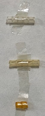 ステントグラフト